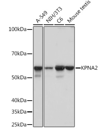 KPNA2 Rabbit Monoclonal Antibody