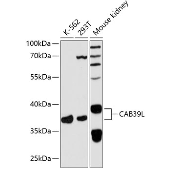 CAB39L Rabbit Polyclonal Antibody