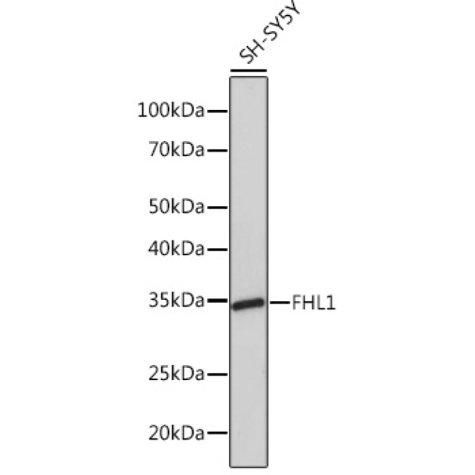 FHL1 Rabbit Monoclonal Antibody