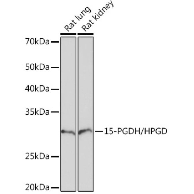 15-PGDH/HPGD Rabbit Monoclonal Antibody