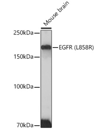 EGFR (L858R) Rabbit Monoclonal Antibody