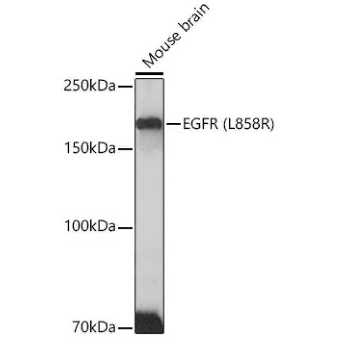 EGFR (L858R) Rabbit Monoclonal Antibody