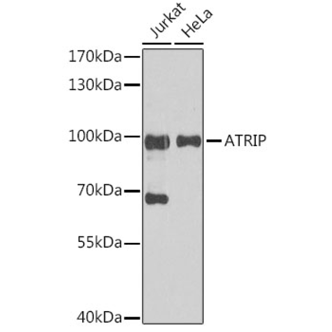 ATRIP Rabbit Polyclonal Antibody