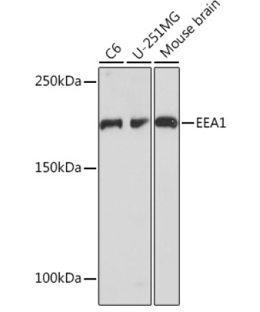 EEA1 Rabbit Monoclonal Antibody