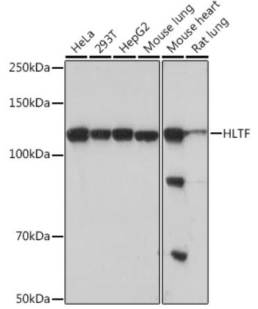 HLTF Rabbit Monoclonal Antibody