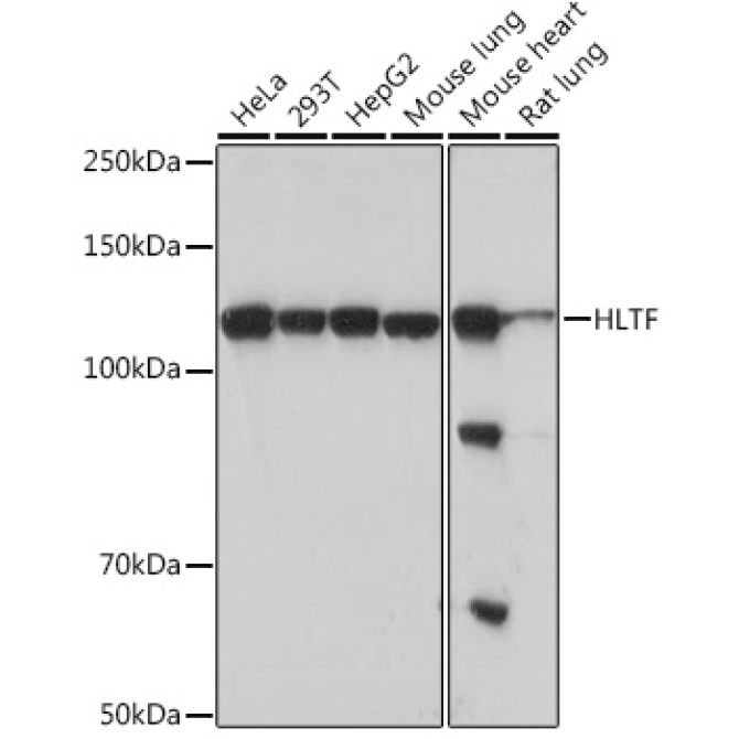 HLTF Rabbit Monoclonal Antibody