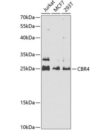 CBR4 Rabbit Polyclonal Antibody