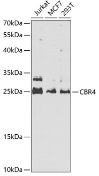 CBR4 Rabbit Polyclonal Antibody