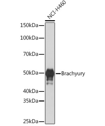 Brachyury Rabbit Monoclonal Antibody
