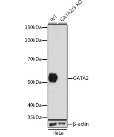 GATA2/3 Rabbit Monoclonal Antibody [KO Validated]