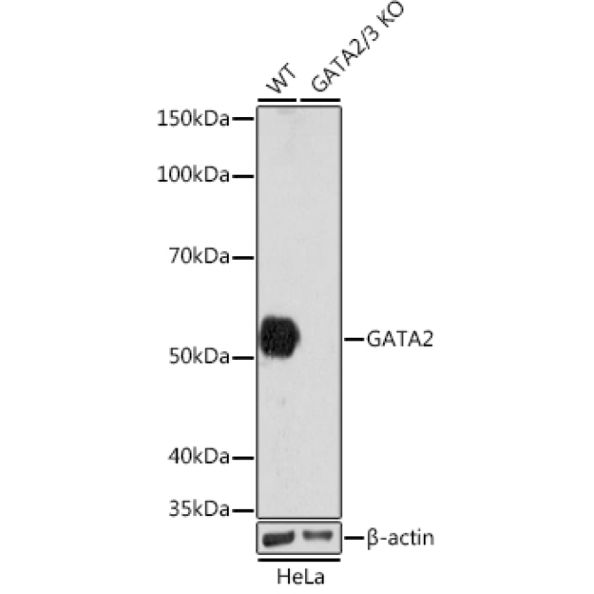 GATA2/3 Rabbit Monoclonal Antibody [KO Validated]