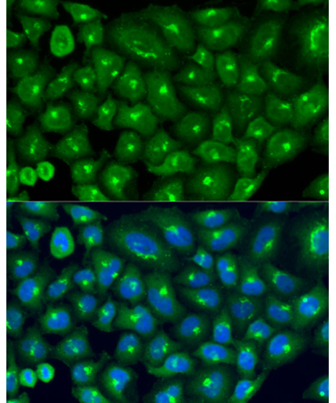 COG7 Rabbit Polyclonal Antibody