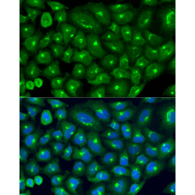 COG7 Rabbit Polyclonal Antibody