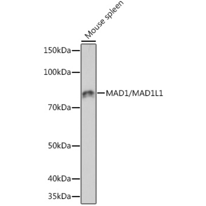 MAD1/MAD1L1 Rabbit Monoclonal Antibody
