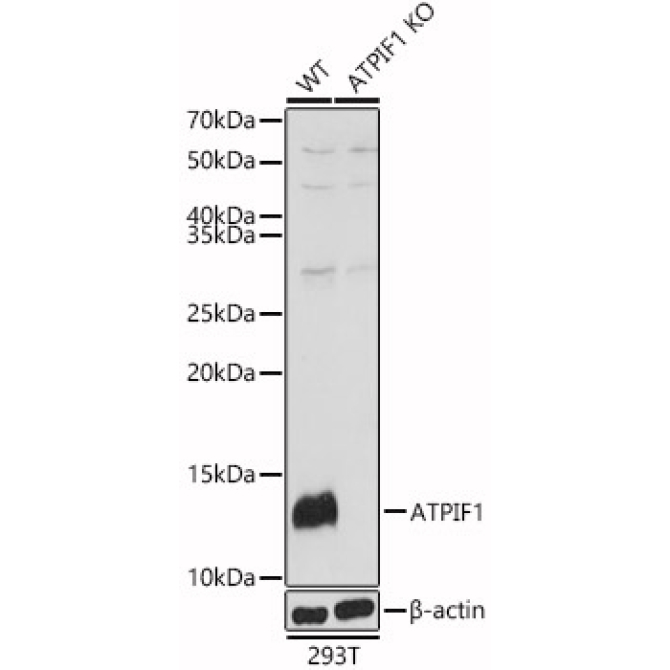 ATPIF1 Rabbit Polyclonal Antibody [KO Validated]