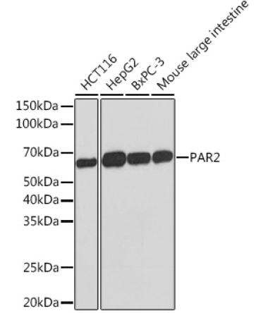 PAR2 Rabbit Monoclonal Antibody