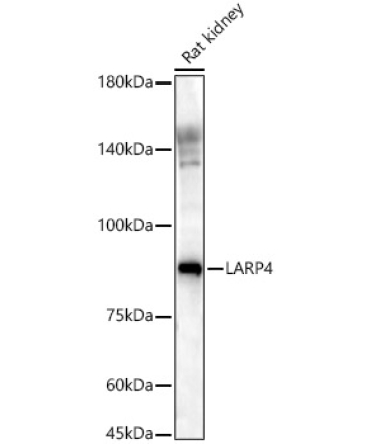 LARP4 Rabbit Polyclonal Antibody