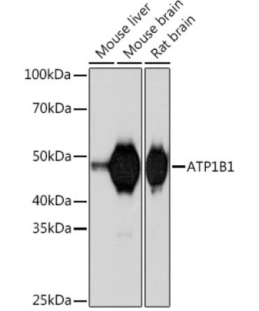 ATP1B1 Rabbit Monoclonal Antibody