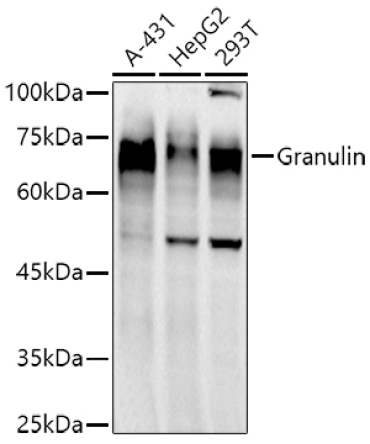 Granulin Rabbit Monoclonal Antibody