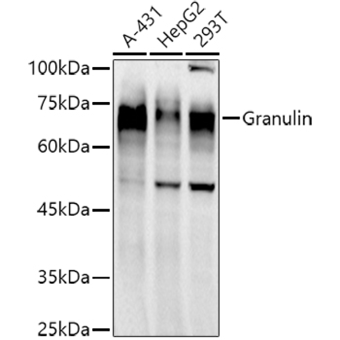 Granulin Rabbit Monoclonal Antibody