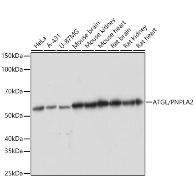 ATGL/PNPLA2 Rabbit Monoclonal Antibody