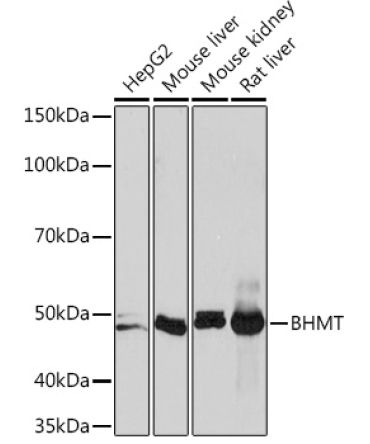 BHMT Rabbit Monoclonal Antibody