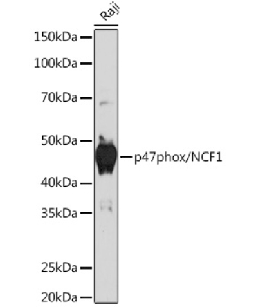 p47phox/NCF1 Rabbit Monoclonal Antibody