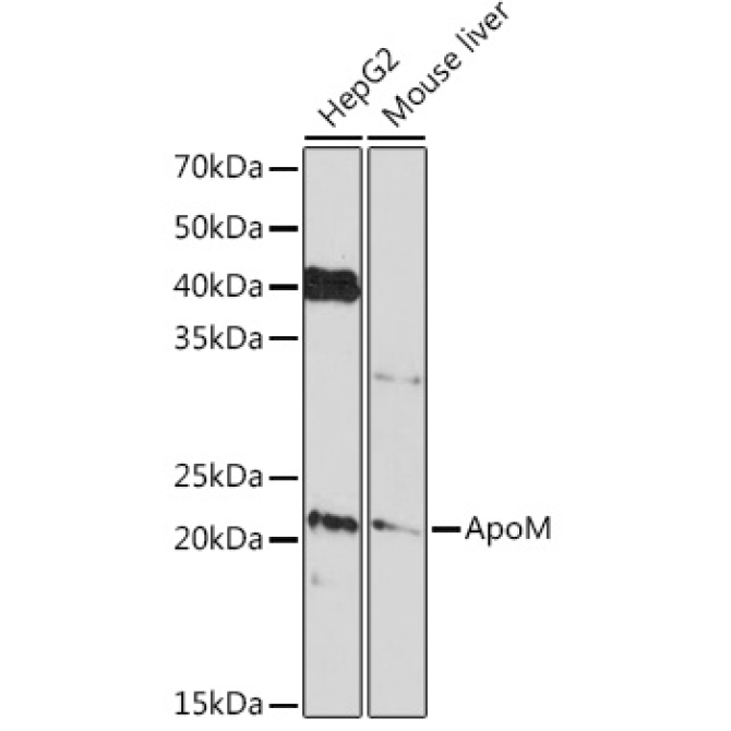 ApoM Rabbit Monoclonal Antibody