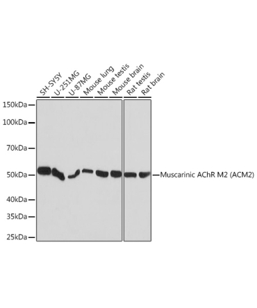 Muscarinic AChR M2 (ACM2) Rabbit Monoclonal Antibody