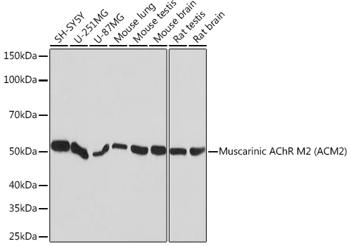 Muscarinic AChR M2 (ACM2) Rabbit Monoclonal Antibody