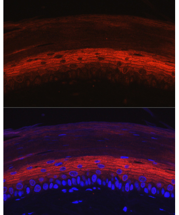 KRT80 Rabbit Polyclonal Antibody