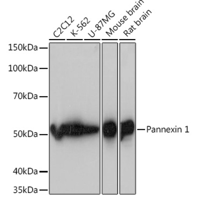 Pannexin 1 Rabbit Monoclonal Antibody