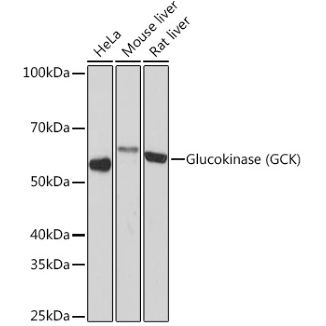 Glucokinase (GCK) Rabbit Monoclonal Antibody