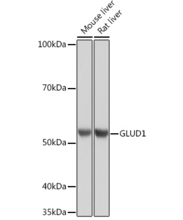 GLUD1 Rabbit Monoclonal Antibody