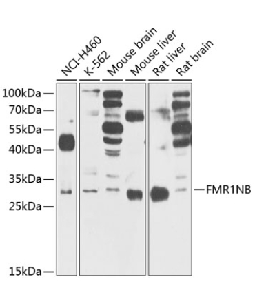 FMR1NB Rabbit Polyclonal Antibody
