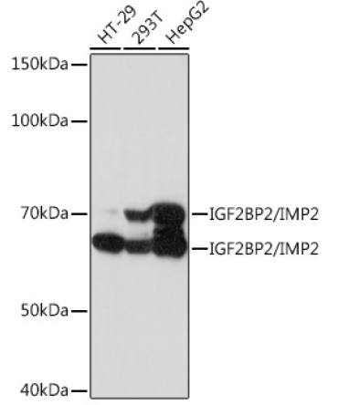 IGF2BP2/IMP2 Rabbit Monoclonal Antibody