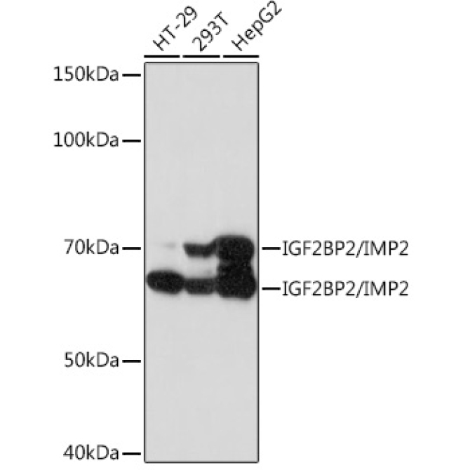 IGF2BP2/IMP2 Rabbit Monoclonal Antibody