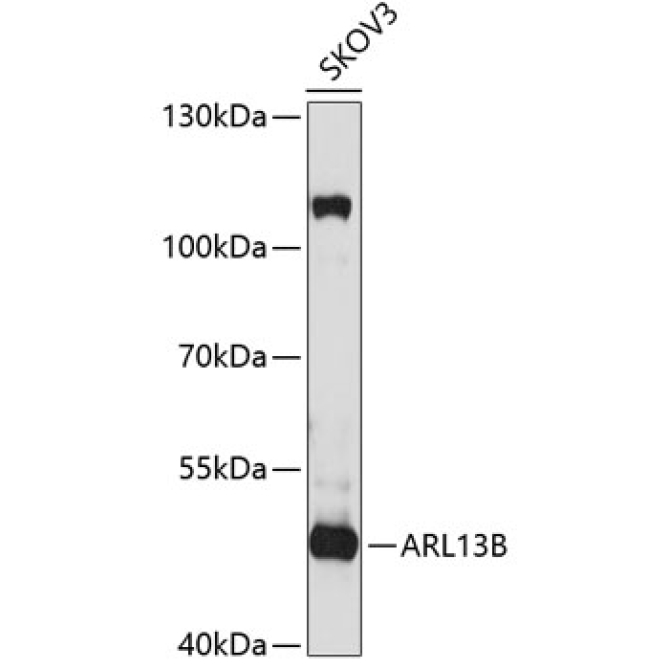 ARL13B Rabbit Polyclonal Antibody