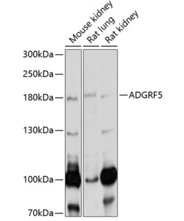 ADGRF5 Rabbit Polyclonal Antibody
