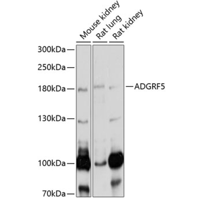 ADGRF5 Rabbit Polyclonal Antibody