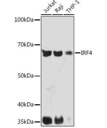 IRF4 Rabbit Monoclonal Antibody
