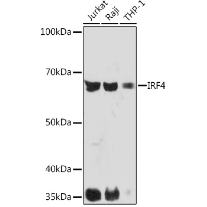 IRF4 Rabbit Monoclonal Antibody