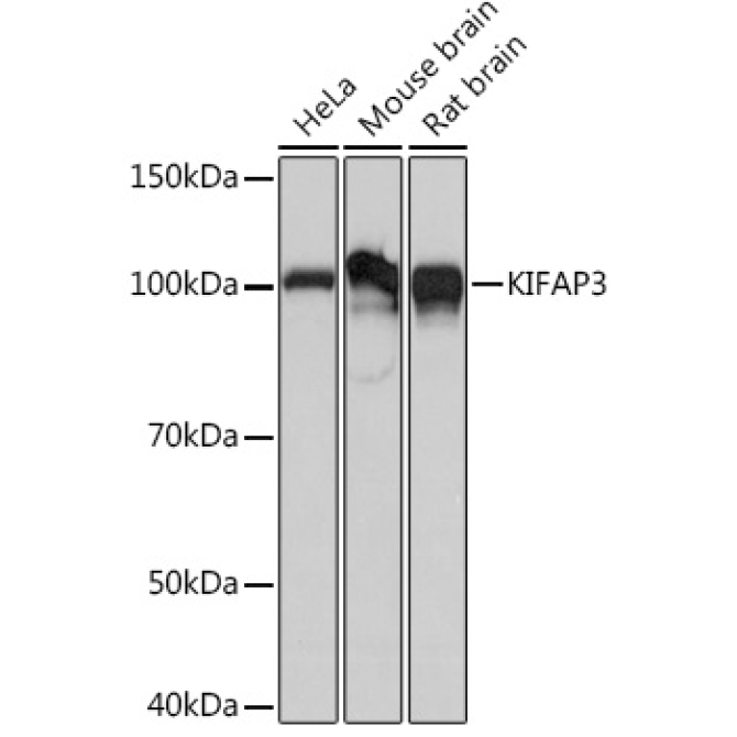 KIFAP3 Rabbit Monoclonal Antibody