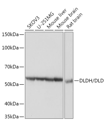 DLDH/DLD Rabbit Monoclonal Antibody