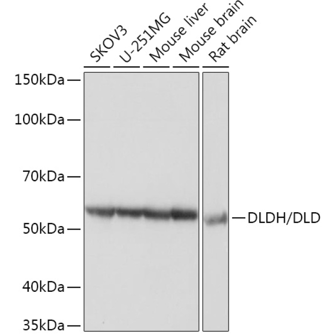 DLDH/DLD Rabbit Monoclonal Antibody