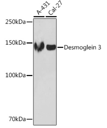 Desmoglein 3 Rabbit Monoclonal Antibody