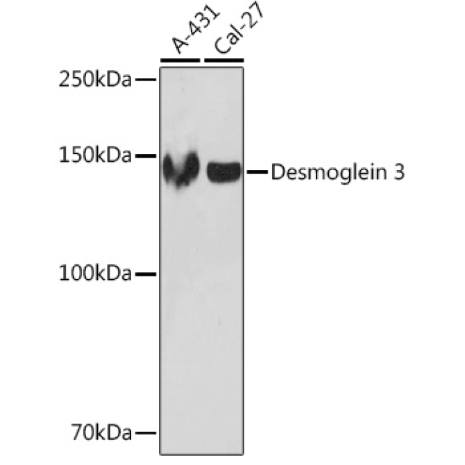 Desmoglein 3 Rabbit Monoclonal Antibody