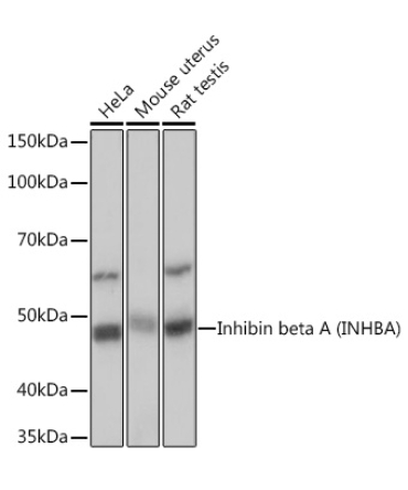 Inhibin beta A (INHBA) Rabbit Monoclonal Antibody