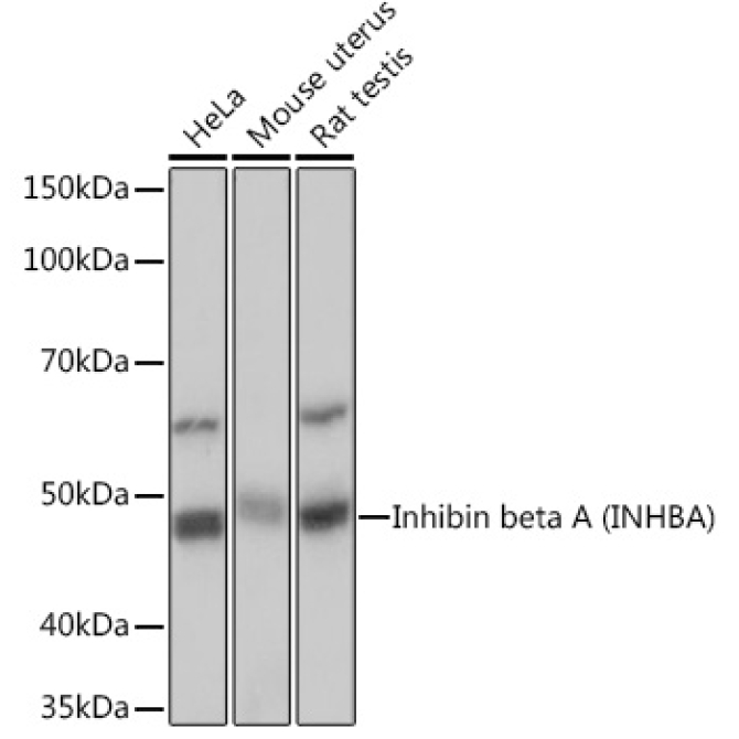 Inhibin beta A (INHBA) Rabbit Monoclonal Antibody