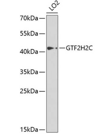 GTF2H2C Rabbit Polyclonal Antibody